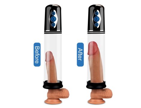 Maximizer Worx Elite Rechargeable Pump - 5