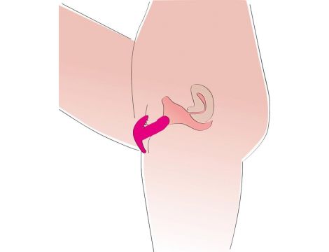 My little secret silicone - 9