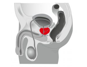 Plug/prostata-Joystick Prostata Booster, black