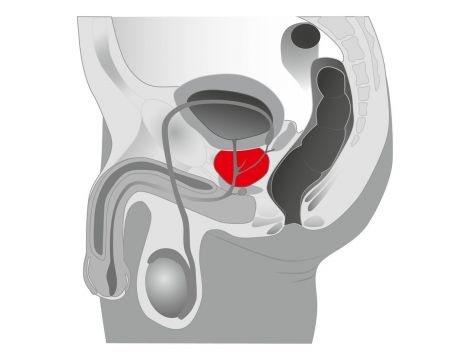 Plug/prostata-Joystick Prostata Booster, black