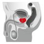 Plug/prostata-Joystick Prostata Booster, black - 2