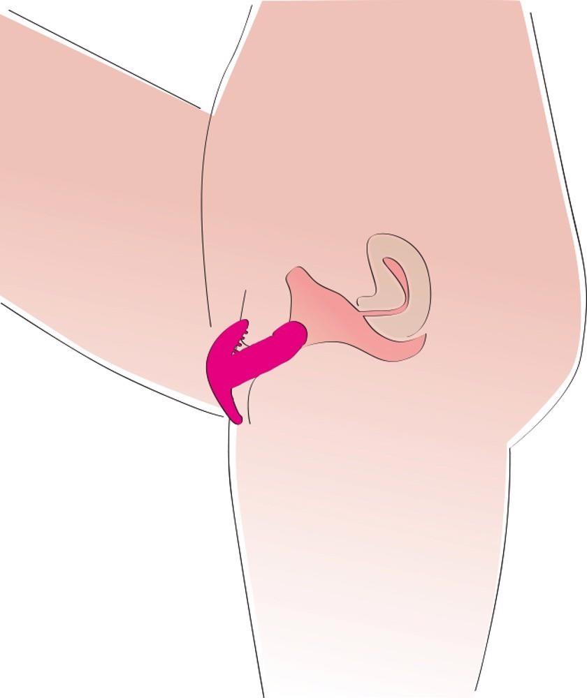 my little secret silicone